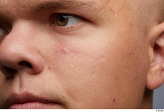 HD Face Skin Jerome cheek face head nose skin pores…